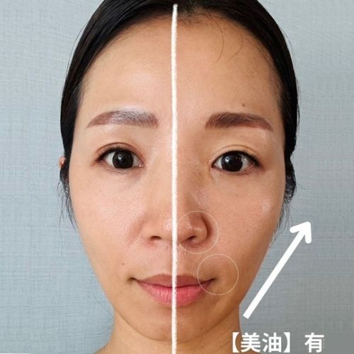 【数量限定】美油-心-　2025年新作　水素オイル(美活道®SHOPさん)のメインイメージ