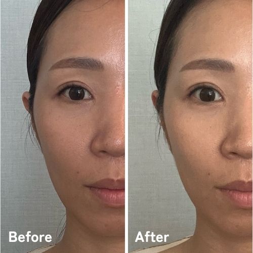 【数量限定】美油-心-　2025年新作　水素オイル(美活道®SHOPさん)のメインイメージ